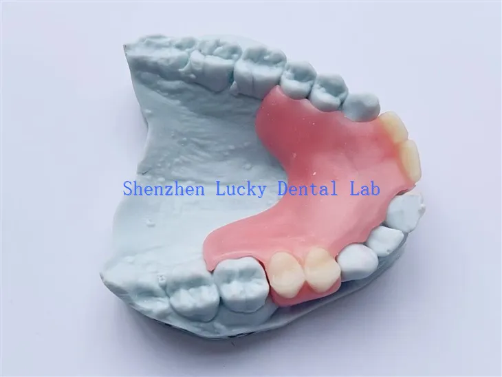 جرب الأسنان المرنة الجزئية المخصصة للأسنان في الشركات المصنعة