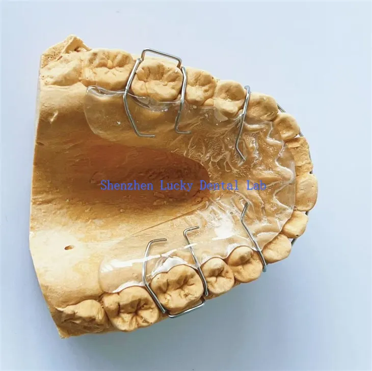 Customized Hawley Retainer Dental Lab