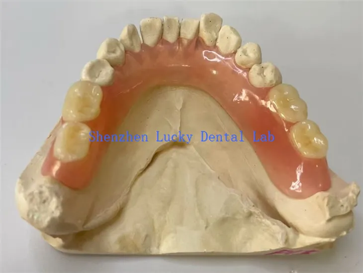 مختبر طب الأسنان المرن الجزئي