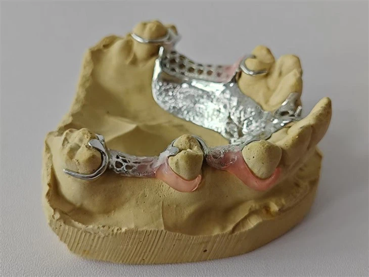 راحة معدنية عالية الجودة ميسيال وبعيدة مع مختبر الأسنان فالس