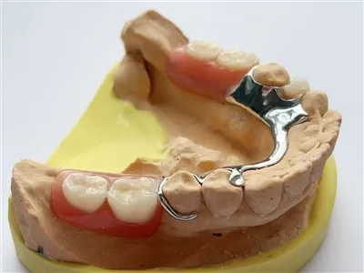 الإطار المعدني اللغوي الصيني اللغوي مع مصنع أسنان أكريليك جزئي