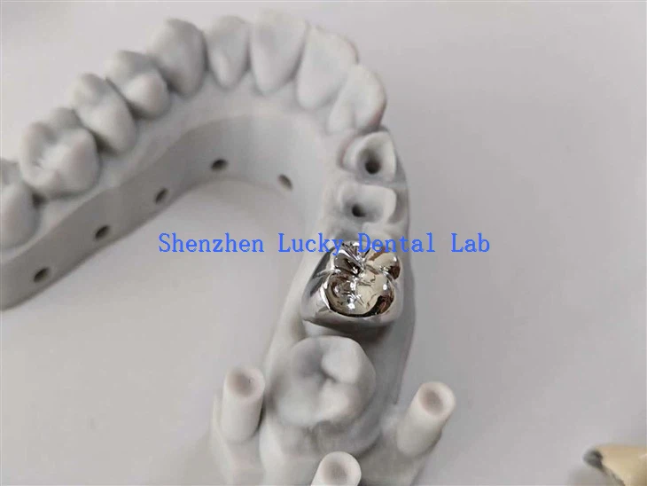 عالي الجودة ثلاثية الأبعاد طباعة مختبر الأسنان المعدني الكامل